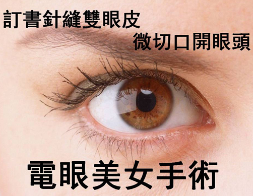 電眼美女來囉!【訂書針縫雙眼皮●微切口開眼頭手術】